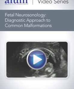 Fetal Neurosonology: Diagnostic Approach to Common Malformations