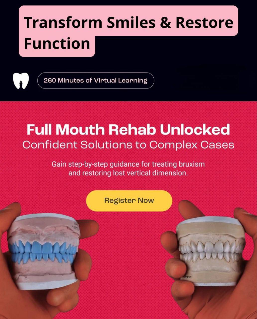 Full Mouth Rehab Unlocked - Confident Solution to Complex Cases