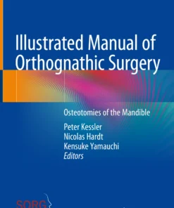 Illustrated Manual of Orthognathic Surgery Osteotomies of the Mandible