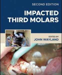 Impacted Third Molars, 2nd Edition pdf