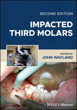 Impacted Third Molars, 2nd Edition pdf