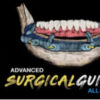 Implant Ninja, Advanced Surgical Guides – All on X