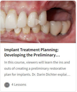 Implant Treatment Planning: Developing the Preliminary Restorative Plan