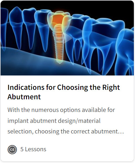 Indications for Choosing the Right Abutment