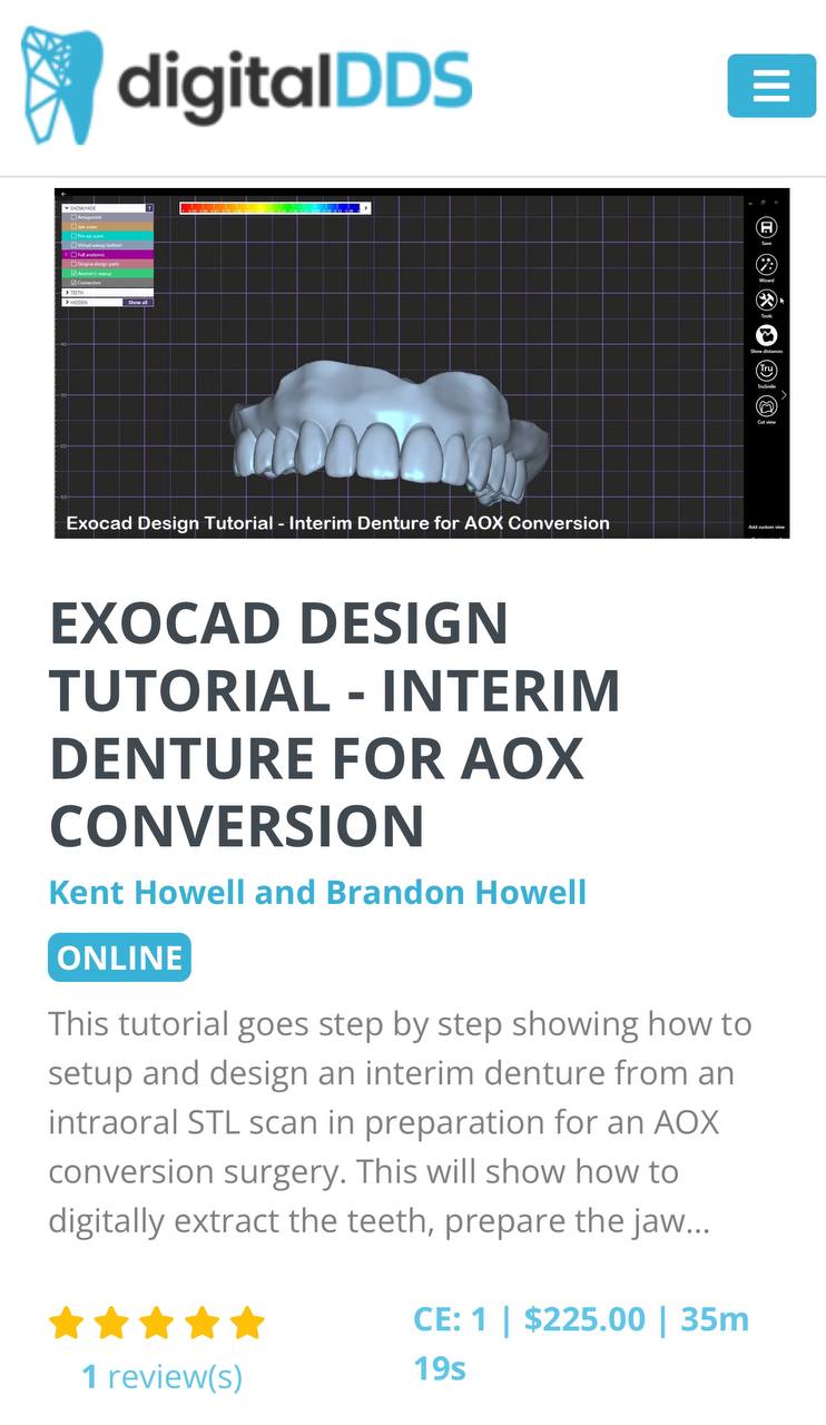 EXOCAD Design Tutorial: Interim Denture For AOX Conversion