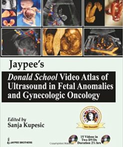 Jaypee’s Donald School Video Atlas of Ultrasound in Fetal Anomalies and Gynecologic Oncology
