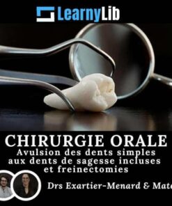 LearnyLib Chirurgie Orale – Exartier-Menard, Mateu Avulsion des dents simples aux dents de sagesse incluses et freinectomies (Francais)