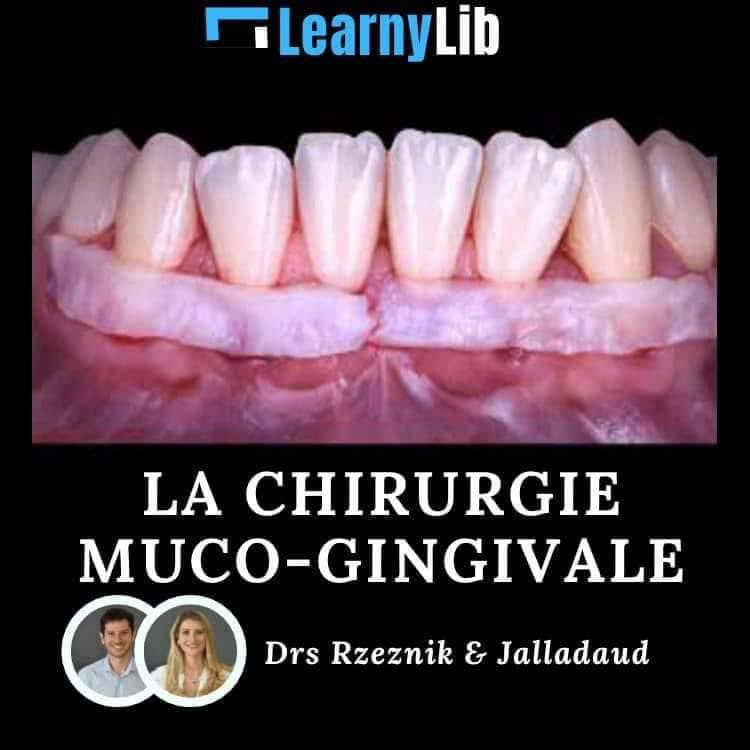 LearnyLib La Chirurgie Muco-Gingivale - Rzeznik & Jalladaud