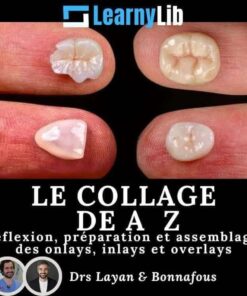 LearnyLib Le Collage de A – Z – Layan, Bonnafous  Reflexion, Preparation et Assemblage des onlays, inlays et overlays (Francais)