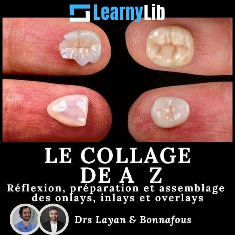 LearnyLib Le Collage de A - Z - Layan, Bonnafous Reflexion, Preparation et Assemblage des onlays, inlays et overlays (Francais)