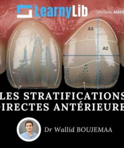 LearnyLib Les Stratifications Directes Anterieures – Ahmed Rabiey – Wallid Boujemaa