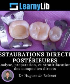 LearnyLib Restaurations Directes Postérieures – Hugues de Belenet Analyse, Preperetion, et Stratirifacation des Composites Directs (Francais)