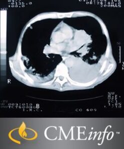 Lung Cancer Imaging 2016 – Videos + PDF