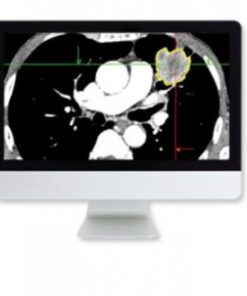 Lung Cancer Screening: A Practical Approach Online Course