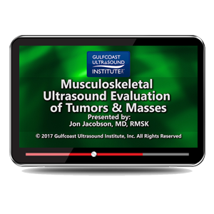MSK Ultrasound Evaluation of Tumors and Masses