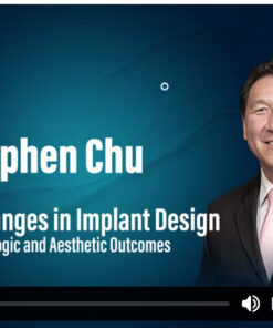 Macro Changes in Implant Design