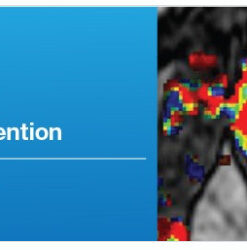 Multi-Parametric Prostate MRI and MR-Guided Intervention - A Video CME Teaching Activity