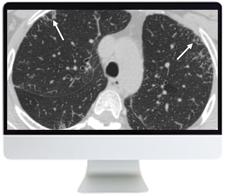 Clinical Case-Based Review of Cardiopulmonary Imaging