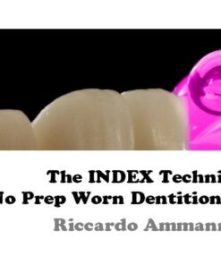 OHI-S - The Index Technique - No Prep Worn Dentition Treatment - Riccardo Ammannato