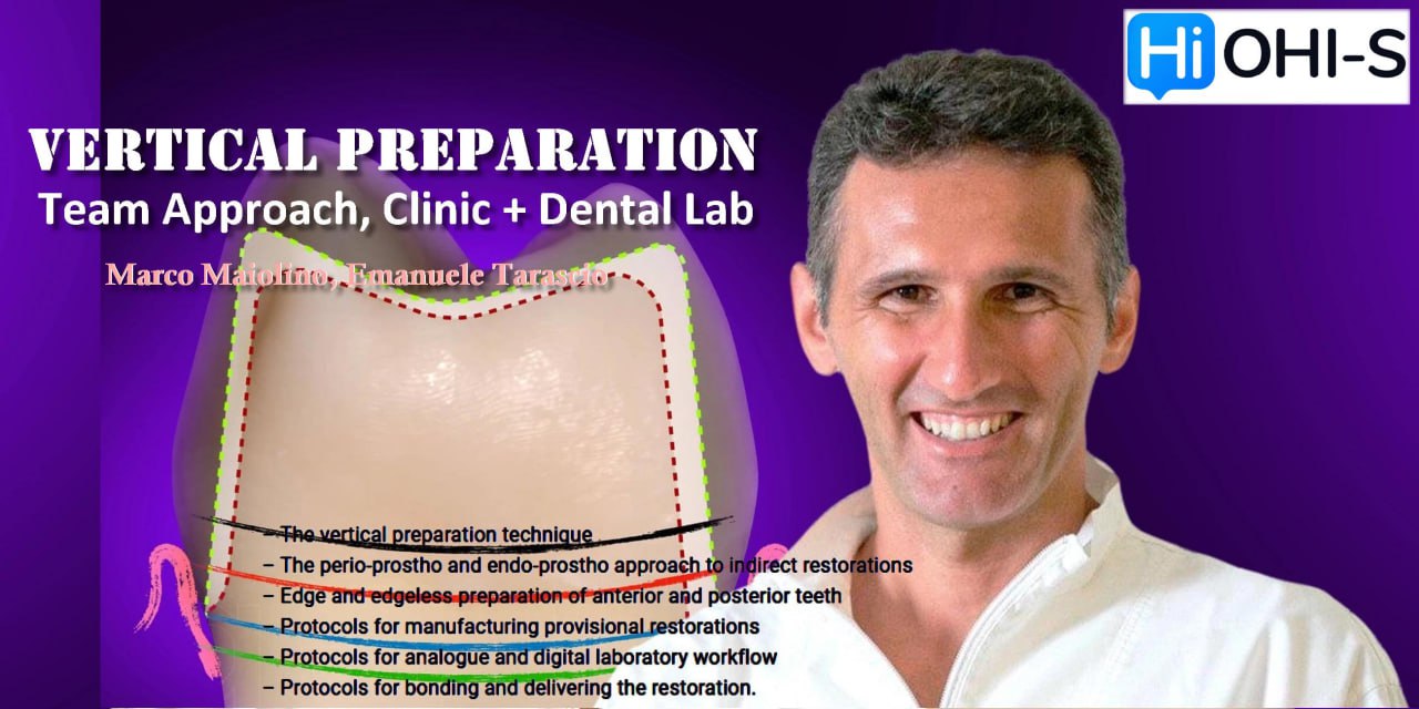 OHI-S Vertical Preparation: Team Approach, Clinic+Dental Lab