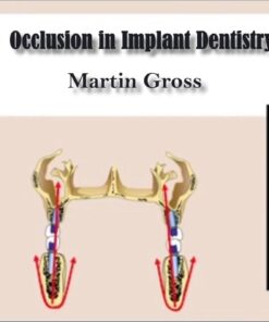Occlusion in Implant Dentistry - Martin Gross