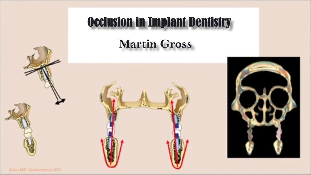 Occlusion in Implant Dentistry - Martin Gross