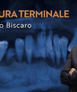 Osteocom Dentatura Terminale – Leonello Biscaro Guida alla transizione verso la protesi a supporto implantare (Italiano)