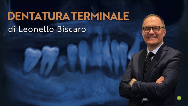 Osteocom Dentatura Terminale - Leonello Biscaro Guida alla transizione verso la protesi a supporto implantare (Italiano)