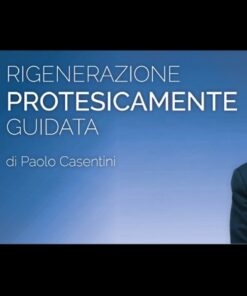 Osteocom Rigenerazione Protesicamente Guidata – Paolo Casentini (italiano)
