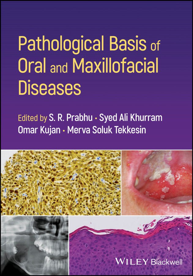 Pathological Basis of Oral and Maxillofacial Diseases / S R Prabhu, Syed Ali Khurram, Omar Kujan, Merva Soluk Tekkesin (2025) PDF Original
