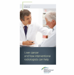 Patient Information Brochure – Liver Cancer