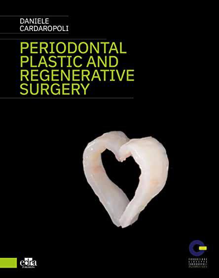 Periodontal plastic and regenerative surgery PDF Periodontal plastic and regenerative surgery PDF