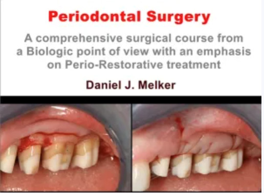 Donato Dental Systems Periodontal Surgery: A Comprehensive Surgical Course