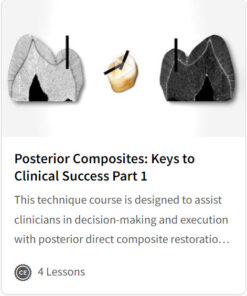 Posterior Composites: Techniques for Great Dentistry