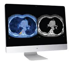 Practical PET/CT: What You Need to Know