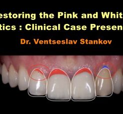 Restoring the Pink and White Esthetics: Clinical Case Presentation