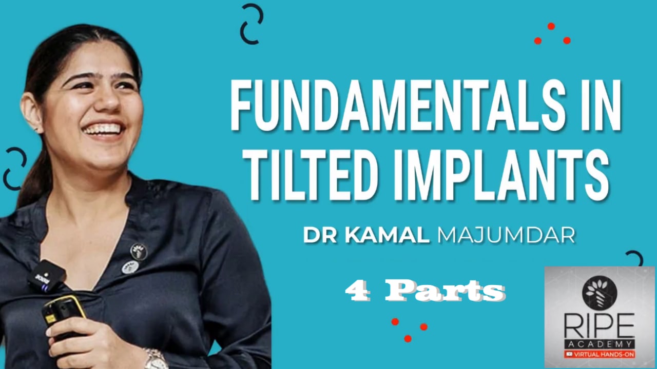 RipeGlobal Fundamentals in Tilted Implants - Kamal Majumdar