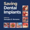 Saving Dental Implants Saving Dental Implants