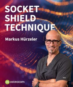 osteocom Socket Shield Technique 2025