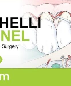Zucchelli Channel, Soft Tissue Esthetic Surgery - Giovanni Zucchelli (italiano)