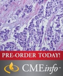 Soft Tissue Tumors
