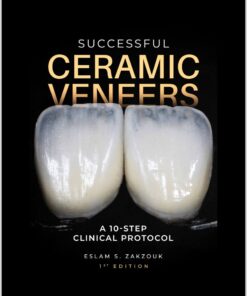 Successful Ceramic Veneers: A 10-Step Clinical Protocol 2023 Original PDF