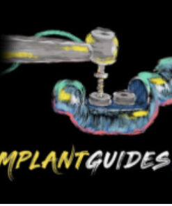Implant Ninja .The Implant Guides 101 Course