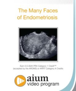 The Many Faces of Endometriosis