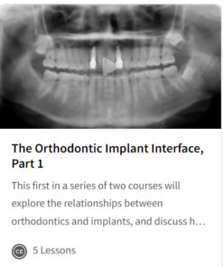 The Orthodontic Implant Interface, Part 1