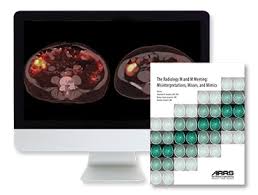The Radiology M and M Meeting: Misinterpretations, Misses, and Mimics