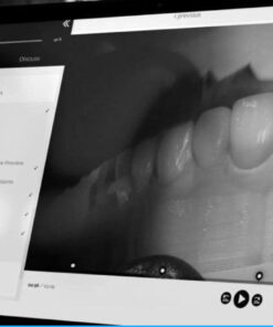 The Smile Design and Smile Preview