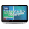 Thyroid Pathology and Ultrasound-Guided Intervention