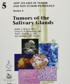Tumors of the Salivary Glands: Series 5 (Original PDF from Publisher)