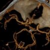 UCSF Interventional Radiology Review